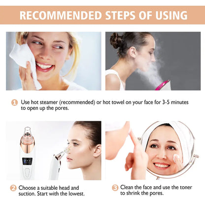 Revolutionary 2026 Blackhead Remover Pore Vacuum - USB Rechargeable with 4 Versatile Tips for Ultimate Skin Care