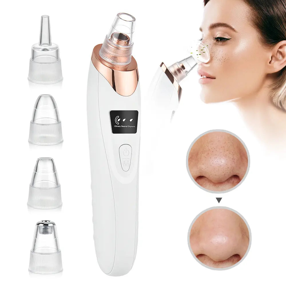 2026 Newest Blackhead Remover Pore Vacuum USB Rechargeable Blackhead Extractor with 4 Replacement Tips for Effective Skin Care Heat Compression Leg Massager Skincare Gadgets